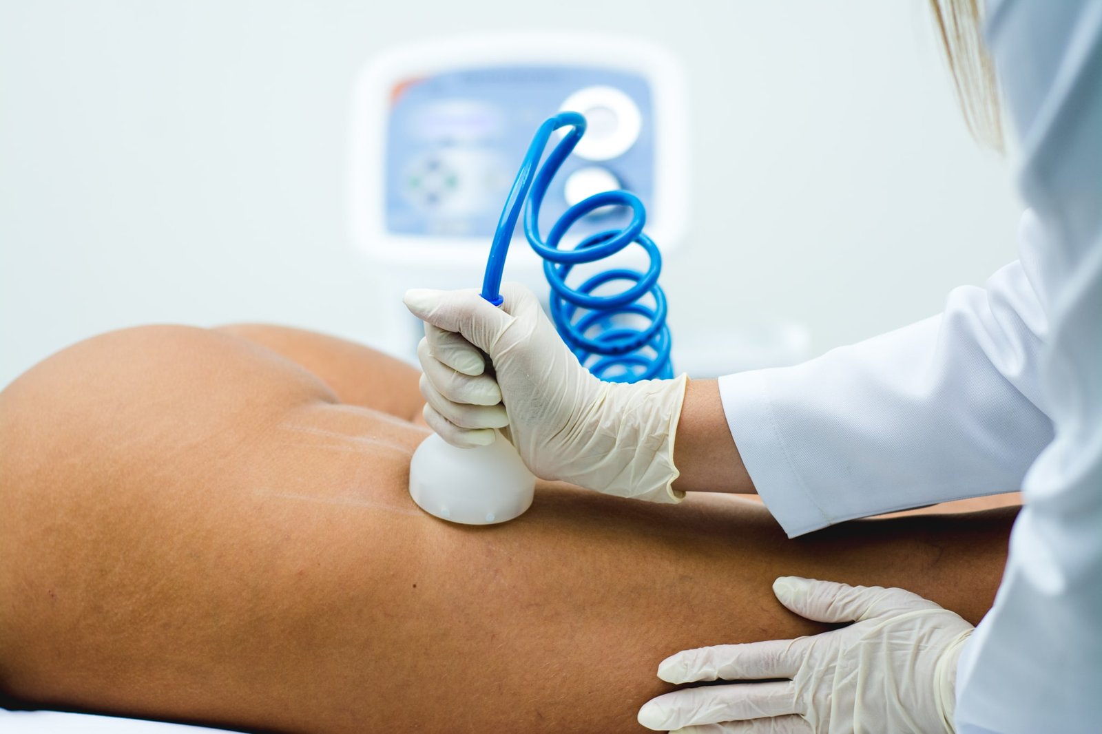 Endermoterapia